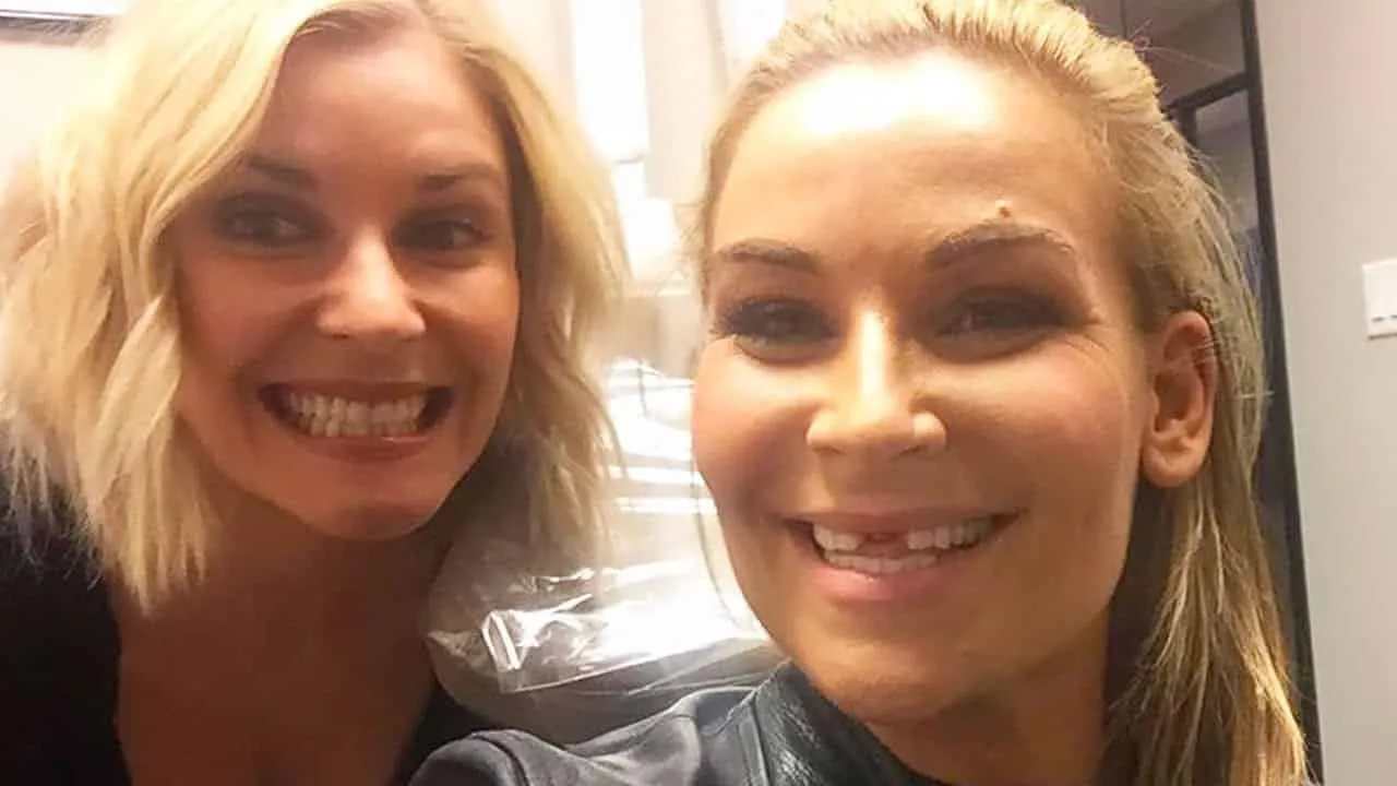 Natalya Neidhart lost her front teeth during a house show match in October 2016. Credits: YouTube.