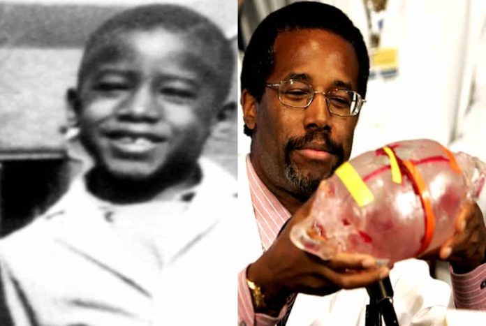 Dr Ben Carson Childhood Story Plus Untold Biography Facts