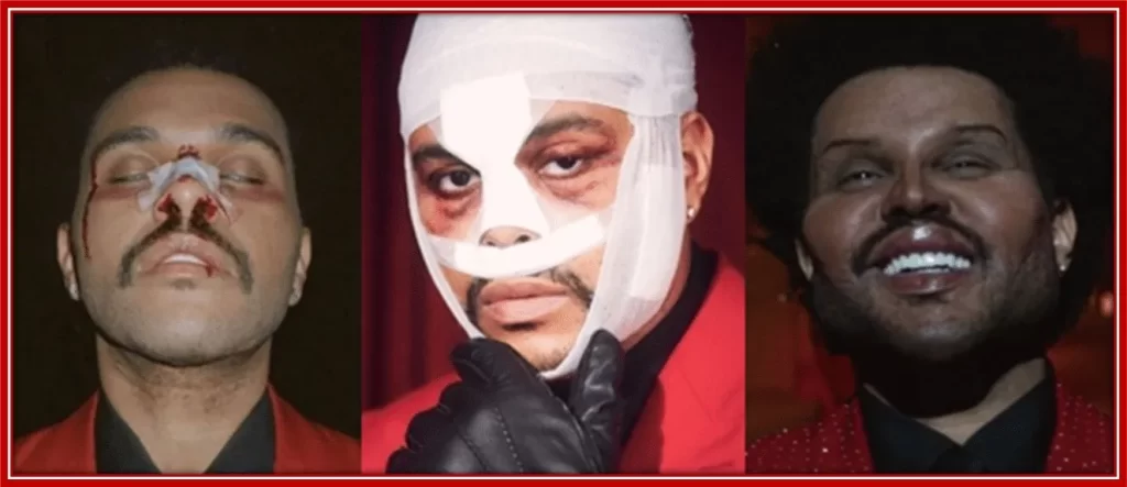The Canadian celebrity sporting a beaten up face, then a face covered in bandages.