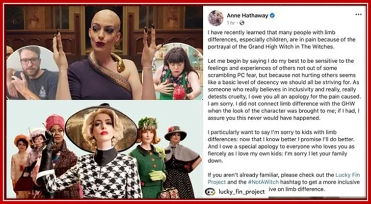 The Apology Letter Anne Hathaway Made to the Limbs Disabled Community for the Misrepresenting of Their Disabilities' as Witches.