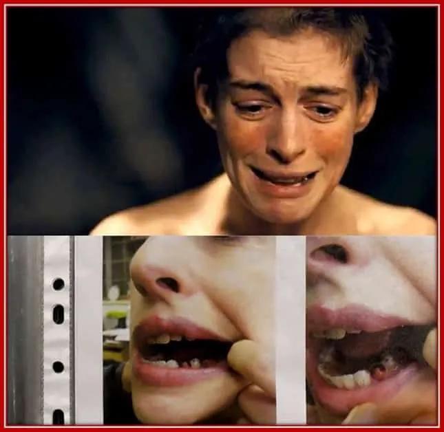 Hathaway's Teeth in the Movie Les Misérables were Painted With Red Blood Marks.