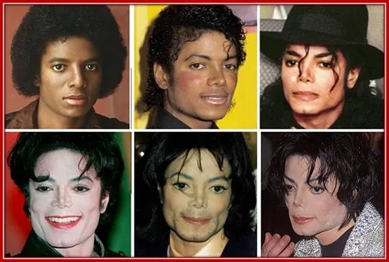 Look at how the Iconic Singer Jackson Transformed with Surgery into a White man.